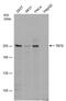 Methylcytosine dioxygenase TET2 antibody, MA5-27838, Invitrogen Antibodies, Western Blot image 
