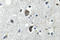 HSP70 antibody, LS-C177163, Lifespan Biosciences, Immunohistochemistry paraffin image 