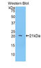 ADAM Metallopeptidase With Thrombospondin Type 1 Motif 12 antibody, LS-C292574, Lifespan Biosciences, Western Blot image 