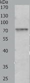 Protein Arginine Methyltransferase 7 antibody, TA324052, Origene, Western Blot image 