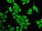 Sca3 antibody, GTX30079, GeneTex, Immunocytochemistry image 