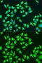 Mitochondrially Encoded ATP Synthase Membrane Subunit 6 antibody, GTX64448, GeneTex, Immunofluorescence image 