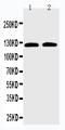 Solute carrier family 12 member 6 antibody, PA2171, Boster Biological Technology, Western Blot image 