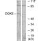 Diacylglycerol Kinase Epsilon antibody, A06615, Boster Biological Technology, Western Blot image 