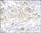 Secreted Frizzled Related Protein 1 antibody, 251666, Abbiotec, Immunohistochemistry paraffin image 