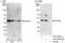 Zinc Finger CCCH-Type Containing 8 antibody, A303-090A, Bethyl Labs, Immunoprecipitation image 