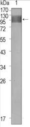Fms Related Tyrosine Kinase 1 antibody, AM06366SU-N, Origene, Western Blot image 