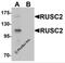 RUN And SH3 Domain Containing 2 antibody, 6659, ProSci, Western Blot image 