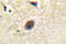 Ras-specific guanine nucleotide-releasing factor 1 antibody, LS-C176631, Lifespan Biosciences, Immunohistochemistry paraffin image 