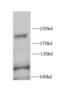 Receptor tyrosine-protein kinase erbB-4 antibody, FNab02829, FineTest, Western Blot image 