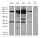 Mediator Complex Subunit 19 antibody, M08777, Boster Biological Technology, Western Blot image 