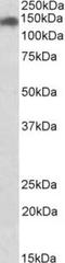 Structural maintenance of chromosomes protein 2 antibody, TA311364, Origene, Western Blot image 