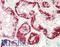 LIM Domain Only 2 antibody, LS-B13458, Lifespan Biosciences, Immunohistochemistry paraffin image 