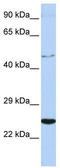 Cytokine receptor-like factor 1 antibody, TA341698, Origene, Western Blot image 