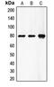 Coagulation factor XIII A chain antibody, LS-C352188, Lifespan Biosciences, Western Blot image 