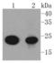 AKAP14 antibody, A15886-1, Boster Biological Technology, Western Blot image 