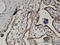 Beta-Ureidopropionase 1 antibody, LS-C134073, Lifespan Biosciences, Immunohistochemistry paraffin image 