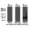 Leucine Rich Repeat Kinase 2 antibody, 73-308, Antibodies Incorporated, Western Blot image 