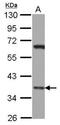 LIM Homeobox 8 antibody, NBP2-19350, Novus Biologicals, Western Blot image 
