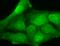 Potassium Calcium-Activated Channel Subfamily M Regulatory Beta Subunit 3 antibody, SMC-330D-A594, StressMarq, Immunocytochemistry image 