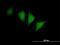 Cyclin-dependent kinase 14 antibody, H00005218-B01P, Novus Biologicals, Immunocytochemistry image 