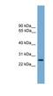 Leucine Rich Repeat Containing 3 antibody, NBP1-70624, Novus Biologicals, Western Blot image 