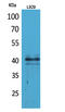C-C chemokine receptor type 4 antibody, STJ96655, St John