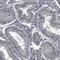 CCT antibody, HPA037984, Atlas Antibodies, Immunohistochemistry paraffin image 
