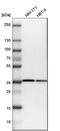 Actin Related Protein 2/3 Complex Subunit 1B antibody, HPA004832, Atlas Antibodies, Western Blot image 