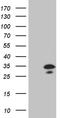Clathrin Light Chain A antibody, LS-C792165, Lifespan Biosciences, Western Blot image 