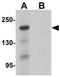 BCL9 Like antibody, GTX32006, GeneTex, Western Blot image 