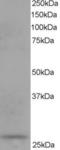 Dicarbonyl And L-Xylulose Reductase antibody, EB05518, Everest Biotech, Western Blot image 