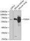P2X purinoceptor 4 antibody, A04715, Boster Biological Technology, Western Blot image 