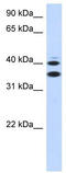Solute Carrier Family 25 Member 32 antibody, TA333641, Origene, Western Blot image 