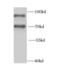 Heterogeneous nuclear ribonucleoprotein R antibody, FNab03957, FineTest, Western Blot image 