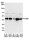 Adenosine Kinase antibody, A304-280A, Bethyl Labs, Western Blot image 