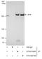 ATR Serine/Threonine Kinase antibody, GTX631845, GeneTex, Immunoprecipitation image 