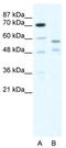 Tripartite Motif Containing 23 antibody, TA335203, Origene, Western Blot image 