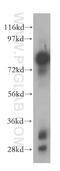 Alkaline Phosphatase, Biomineralization Associated antibody, 11187-1-AP, Proteintech Group, Western Blot image 