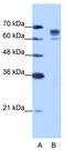 DEAD-Box Helicase 17 antibody, TA343939, Origene, Western Blot image 