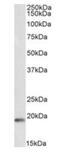 Cold Inducible RNA Binding Protein antibody, orb389361, Biorbyt, Western Blot image 