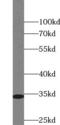 Cyclin Dependent Kinase 4 antibody, FNab01557, FineTest, Western Blot image 