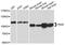 Leucine-rich repeat and death domain-containing protein antibody, STJ24420, St John