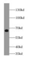 WNK1 antibody, FNab04042, FineTest, Western Blot image 