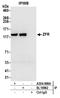 Zinc finger RNA-binding protein antibody, A304-868A, Bethyl Labs, Immunoprecipitation image 