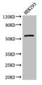 Malonyl-CoA decarboxylase, mitochondrial antibody, CSB-PA014646LA01HU, Cusabio, Western Blot image 