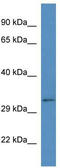 BEN Domain Containing 6 antibody, TA329781, Origene, Western Blot image 