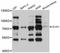 Zinc finger protein GLIS3 antibody, LS-C747337, Lifespan Biosciences, Western Blot image 