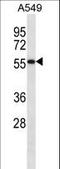 Semenogelin 1 antibody, LS-C168960, Lifespan Biosciences, Western Blot image 