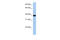 Zinc Finger Protein 781 antibody, 26-564, ProSci, Western Blot image 